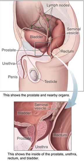 prostata